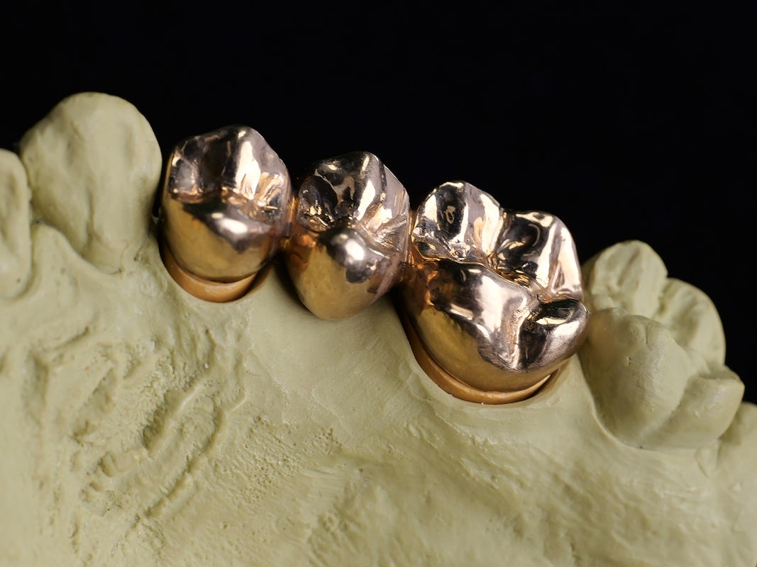 Audental A75 Noble Alloy HIGH NOBL Yellow Au75% for Crown Bridge Restorations