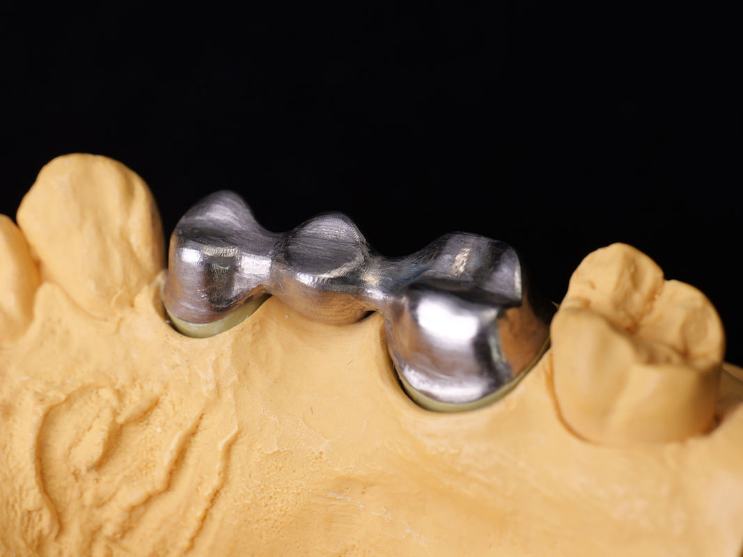 Audental 04 Noble Alloy Silver-Palladium Porcelain Alloy White Pd53.3% for Long-Lasting Dental Restorations