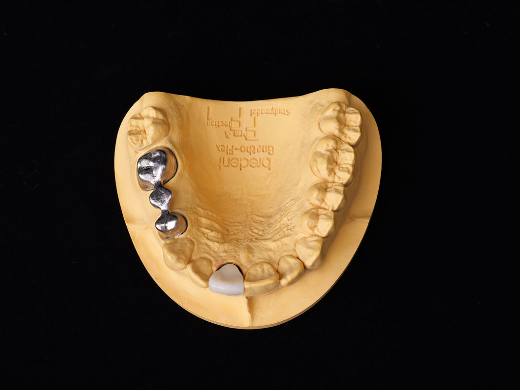Audental 43 Silver-palladium Porcelain Alloy White Pd43% Noble Alloy For Strong And Aesthetic Dental Restorations