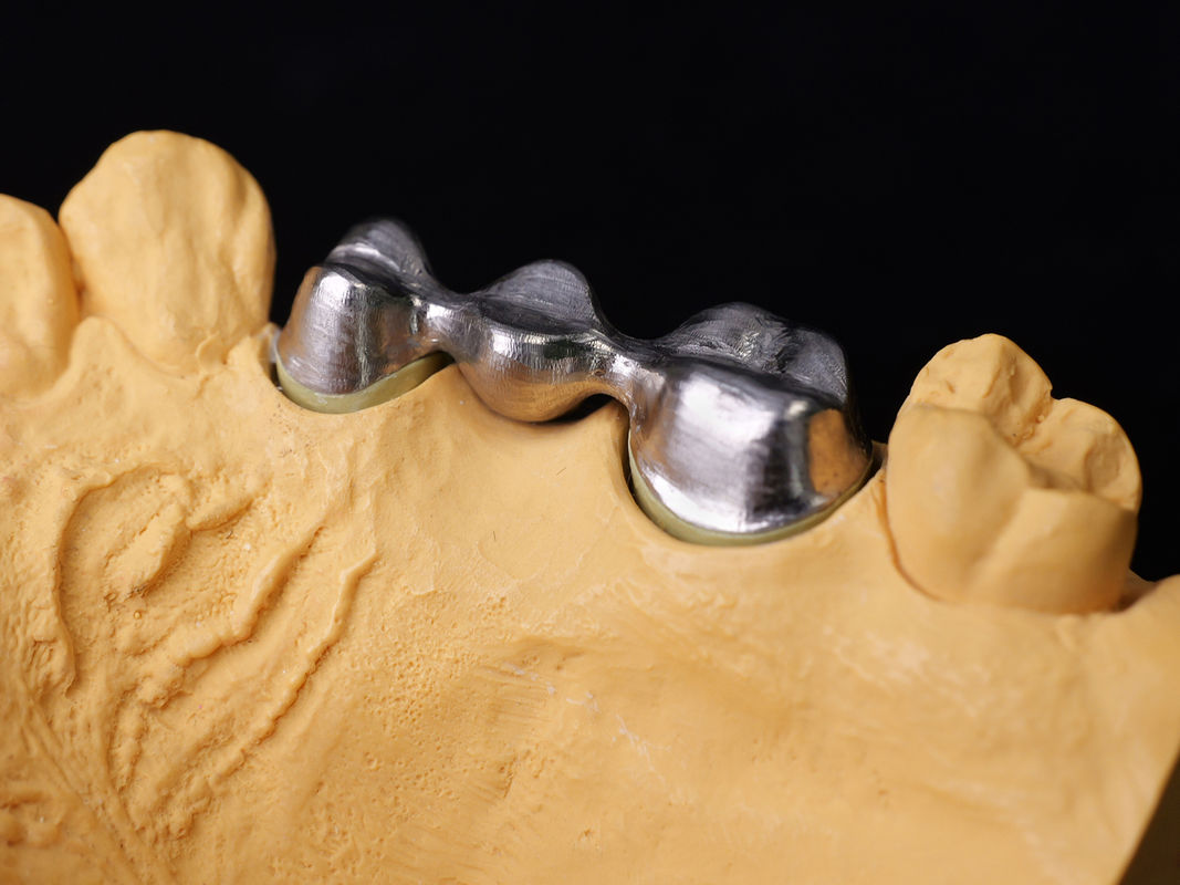 Audental 43 Silver-palladium Porcelain Alloy White Pd43% Noble Alloy For Strong And Aesthetic Dental Restorations