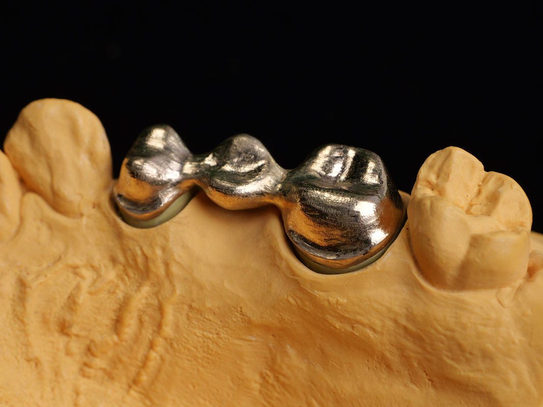 Audental 90 Dental Restorations High Noble Alloy , Dental Ceramic Alloy Yellow Au89.5%