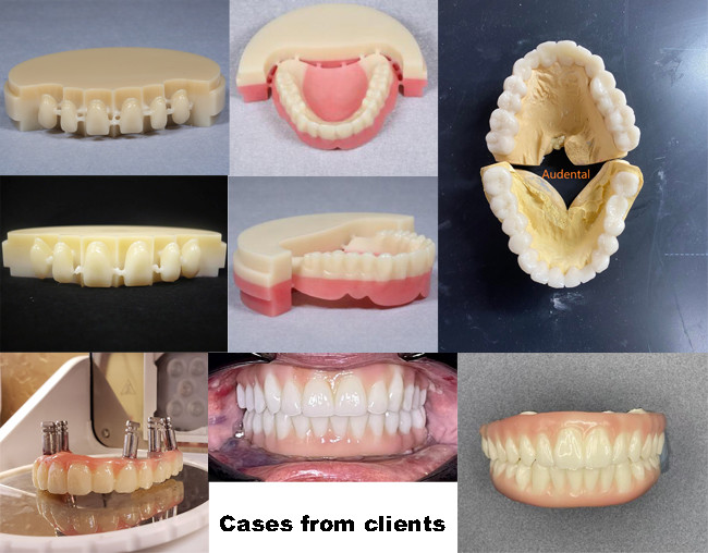 Cad Cam 98mm Dental PMMA Block For Digital Dental Lab Open System